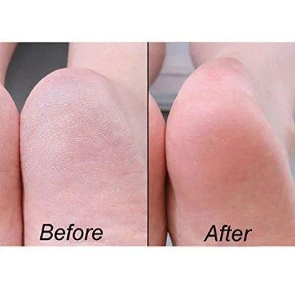 Heel Moisturizing Gel Socks Foot Massage Sleeves Deluxe Comfort Spa